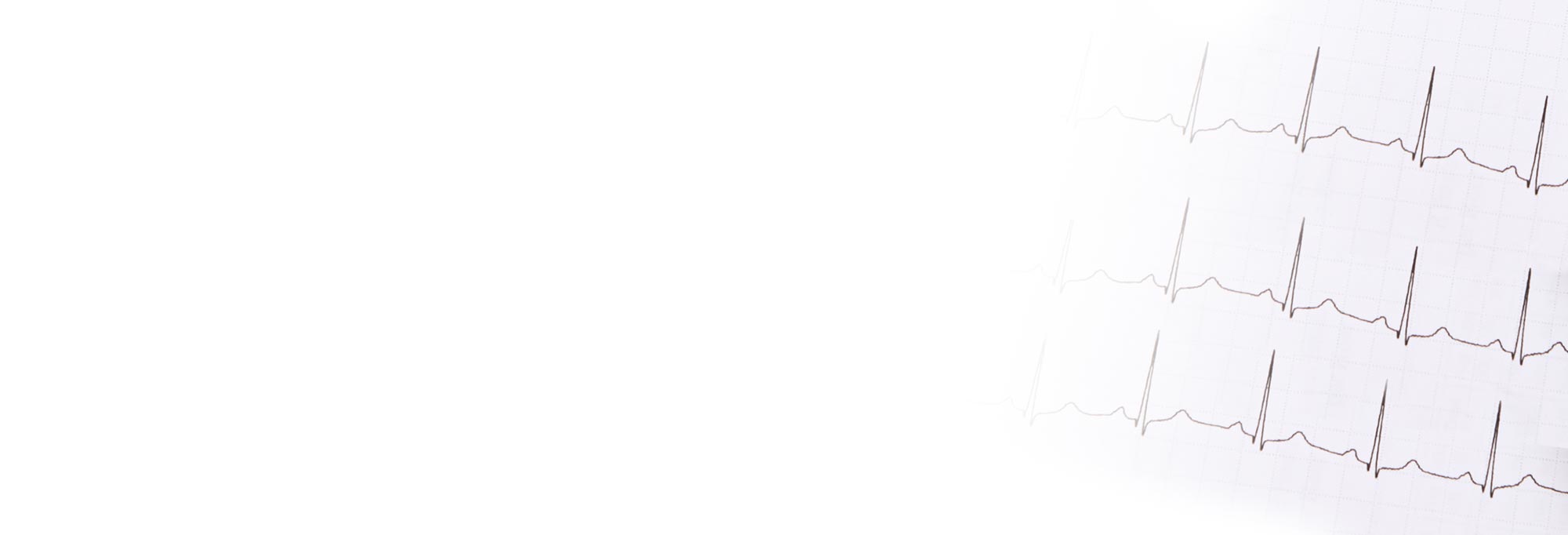 Electrocardiogram (ECG/EKG)