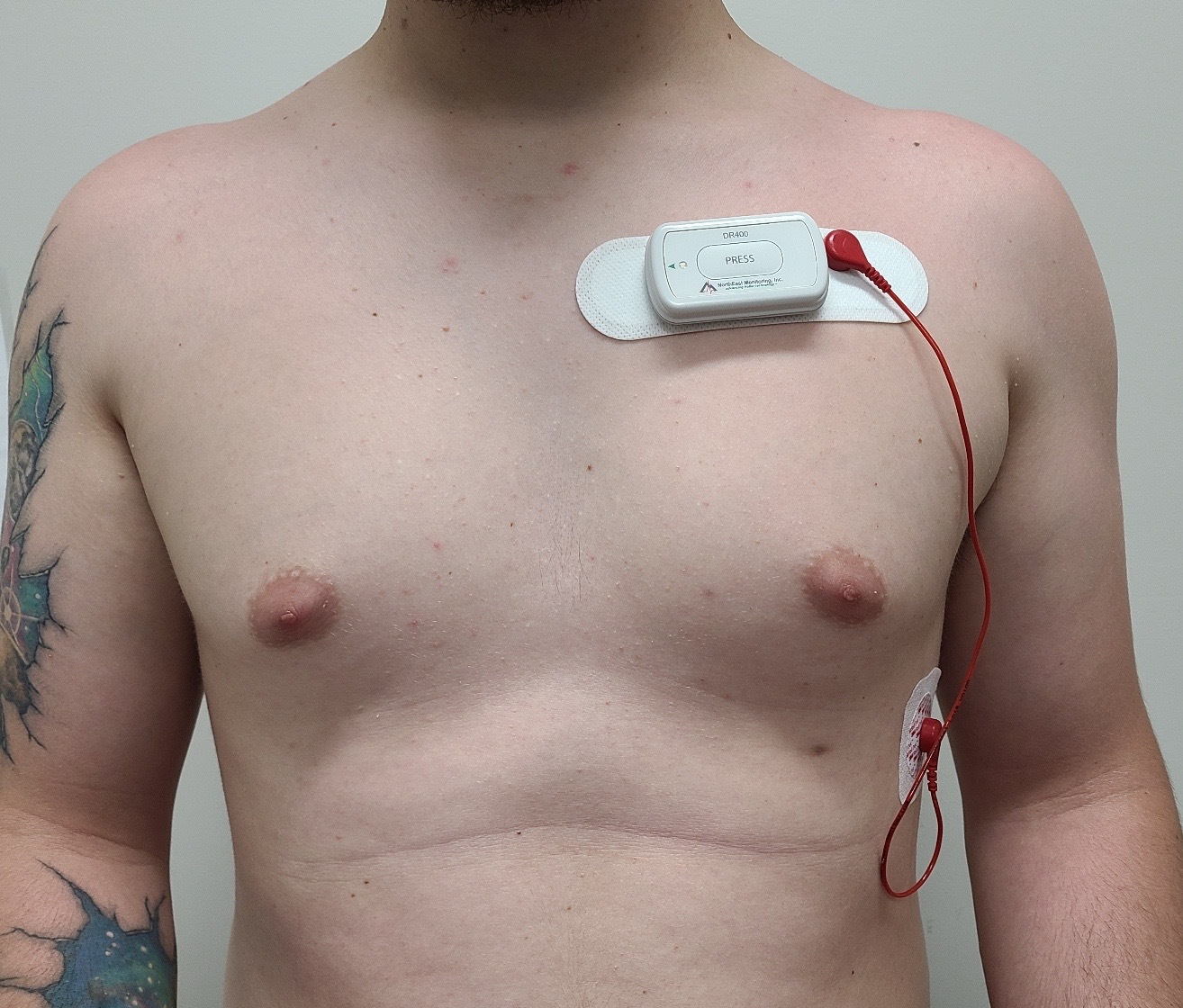 Holter Monitor being worn